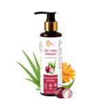 Red Onion Herbal Shampoo | Reduces Hair Fall & Boosts Growth | With Red Onion, Arnica & Aloe Vera | 200 ml